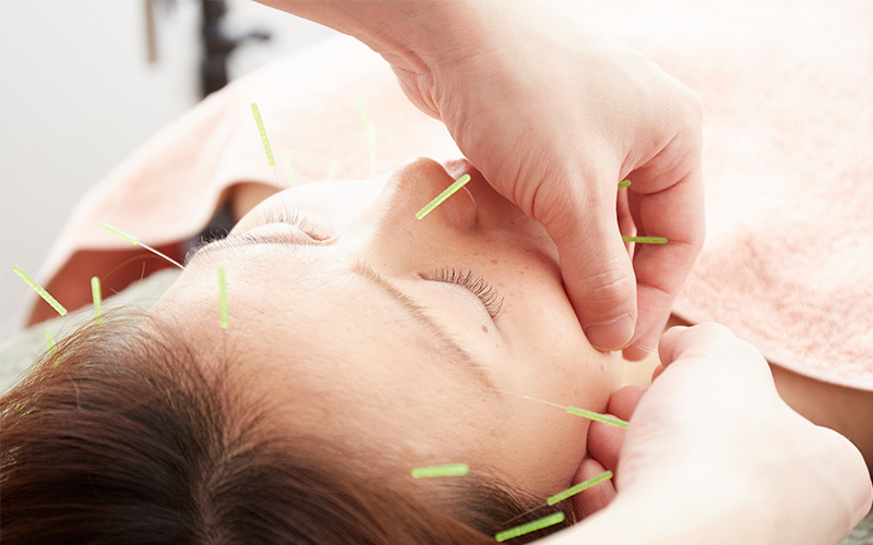 美容鍼 + 姿勢・呼吸へのアプローチで、内側から美しく